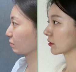 -Yestar 嘉兴艺星医疗美容医院