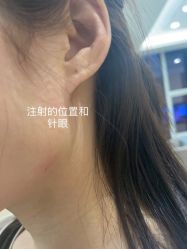 体验后-Yestar艺星医疗美容医院