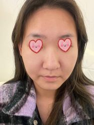 -海涛医疗美容·面部抗衰·注射美鼻