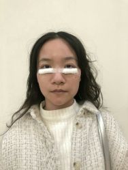 -广州健丽·去眼袋医疗美容机构