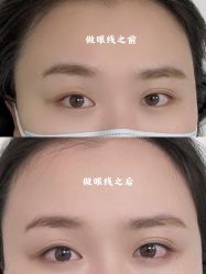 -MISS STAR·半永久纹眉·发际线·美瞳线