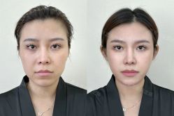 -Yestar艺星医疗美容医院