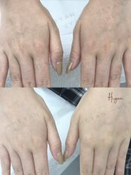 -HEYAN荷妍专业脱毛连锁机构