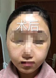 -深圳鹏爱悦心医疗美容医院
