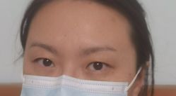 点击看大图 体验后-小忠丽格医美