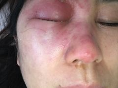 -北京熙仁医院眼科·近视手术专科
