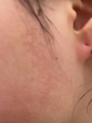 -美瑞莎创美医疗美容