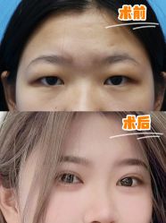 -深圳艺星医疗美容医院