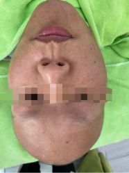 -苗医生草本科技祛痘