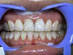 -极光口腔·矫正种植修复(锦江院区)