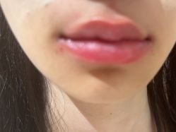 -广东韩妃整形外科医院