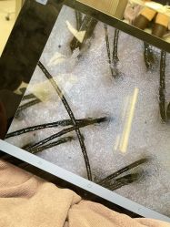 -润复丝·泽发防脱头皮管理
