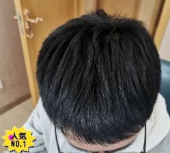 -大麦微针植发丨全国连锁