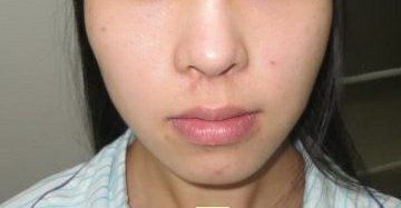 -弘美医美·艾维岚童颜抗衰中心