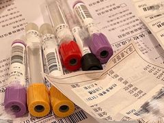 -悦检(南方医科大学第三附属医院体检中心)