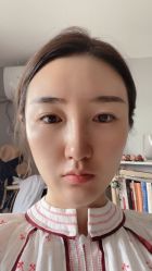 体验后-伊美康医疗美容·抗衰中心