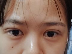 -苏州大学理想眼科医院