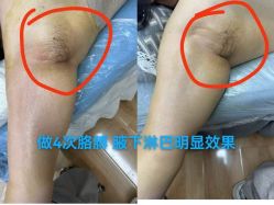 -瑞丝澜国际瘦身