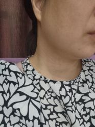 点击看大图 体验前-广州美莱医疗美容医院