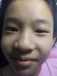 -美人痣全国连锁