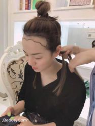 -大麦微针植发丨全国连锁