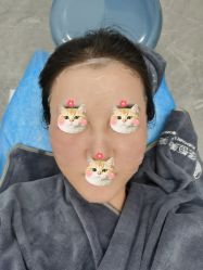 体验后-深圳医恒美医疗美容