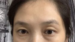 体验前-深圳新建安医疗美容门诊部
