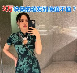 -碧莲盛·不剃发植发
