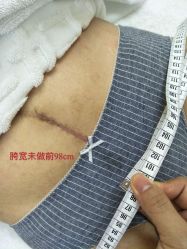-百佳医疗级月子会所