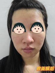体验后-伊丽莎白医疗美容
