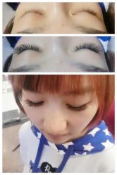 iphone_upload_pic-光SPA科技美肤