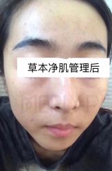 -MLP美丽派·问题肌疗愈中心