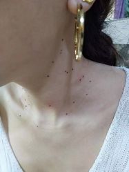 -北京美痣堂古方祛痣斑疣瘊
