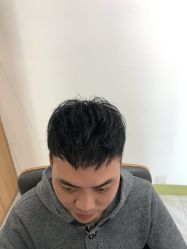 -发饰美男士增发补发假发定制店