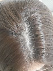 -舒欣头疗·俏丝谧语 白发脱发专业护理 