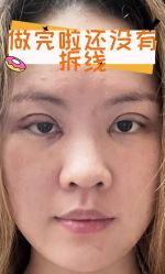-素美医疗美容·西南眼鼻整形·修复基地