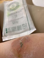 -成都军建医院·疤痕诊疗中心