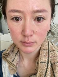 体验前-北京丽星翼美医疗美容