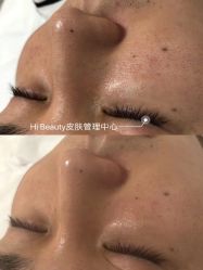 点击看大图 -Hi Beauty Skin 科技美肤中心