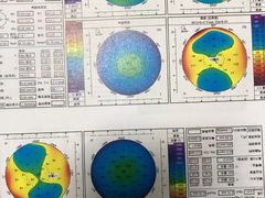 -上海大学附属上海和平眼科医院