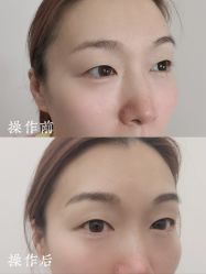 -西施无菌半永久纹绣眉眼影唇轻增发纹发际线