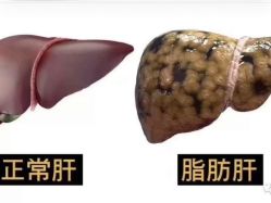 -香薇妮丝·定制减肥·身材管理