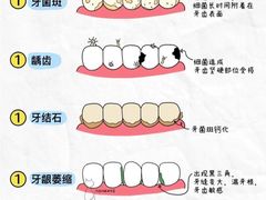 -上海仁爱医院口腔科 · 种植