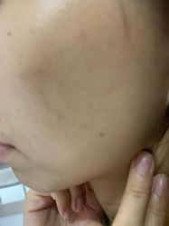 -广州美莱医疗美容医院