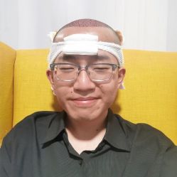 -碧莲盛·不剃发植发