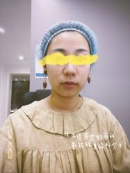 体验前-依萱绮医疗美容