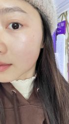 体验后-广州美莱医疗美容医院