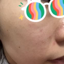点击看大图 体验前-上海宏康医院·医疗美容科