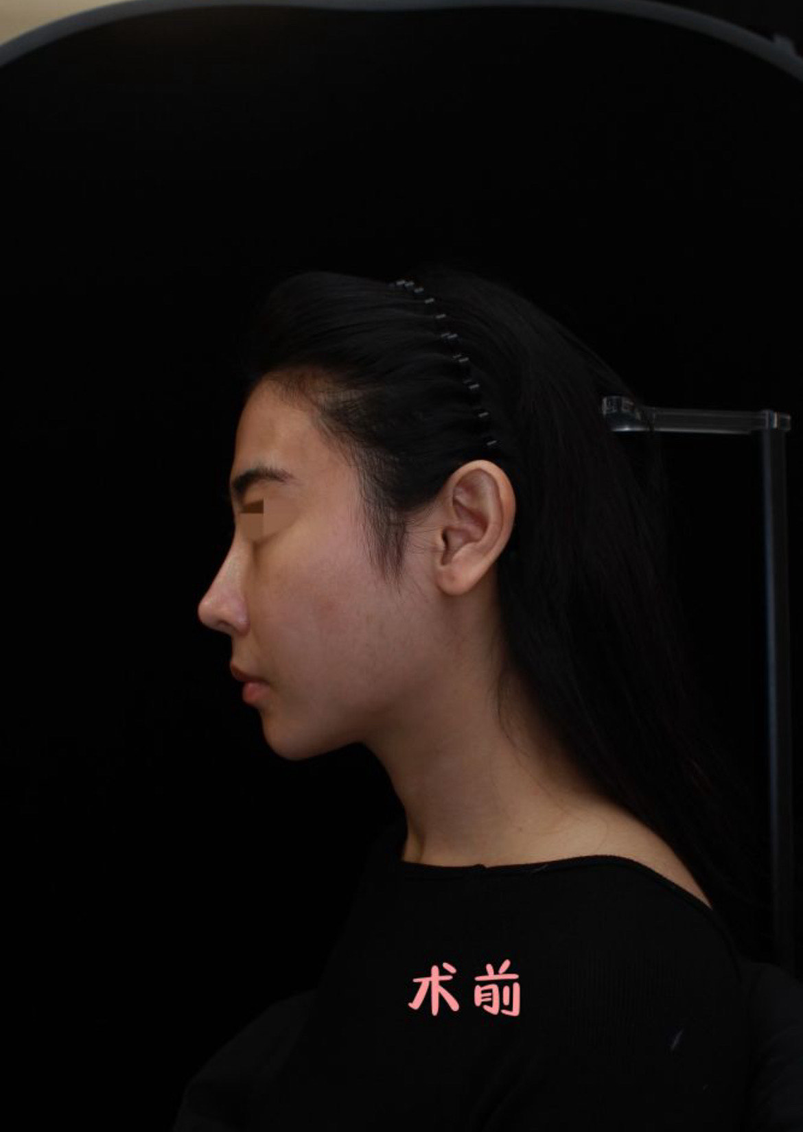 杭州整形美容变美法门
（杭州整形美容医院有哪些）《杭州 整形美容医院》