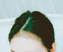 -大麦微针植发丨全国连锁
